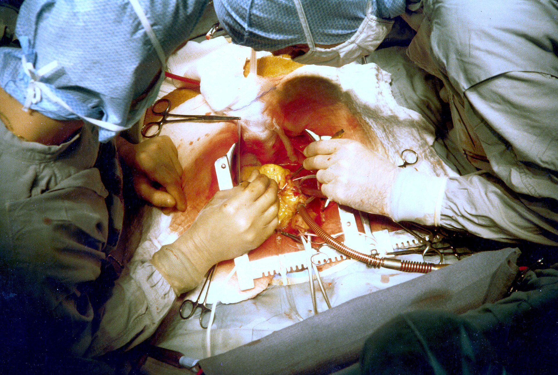 Imagem de referência relacionada a cirurgia torácica, item descrito como registro de referência sobre cirurgia torácica, organizado a partir de dados estruturados abertos
