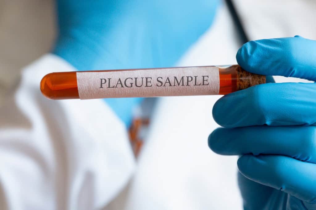 Rússia nega surto de peste pneumônica após morte em laboratório